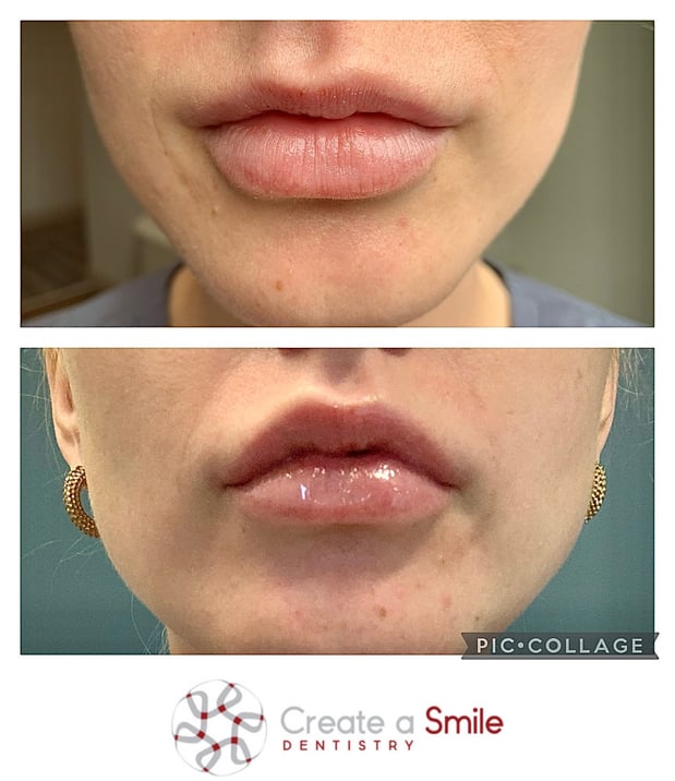 Images Create A Smile Dentistry - Dr. Ken Moore