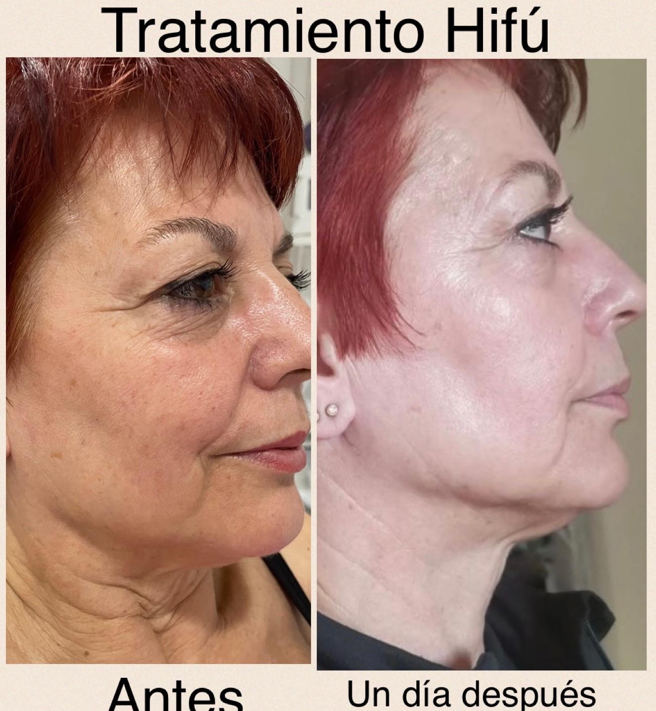 Images Centro De Estética Avanzada Y Láser Verónica Vico