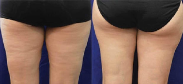 Images EliteBio: Hormone and Aesthetic Solutions