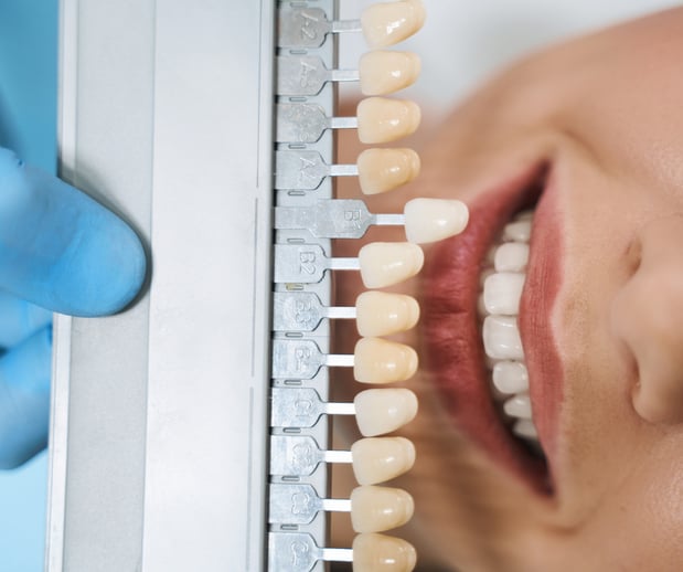 Images Silver State Dental