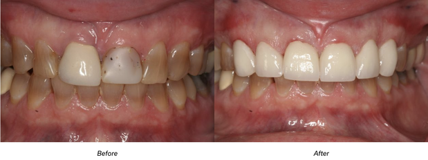 Images Malki Dental