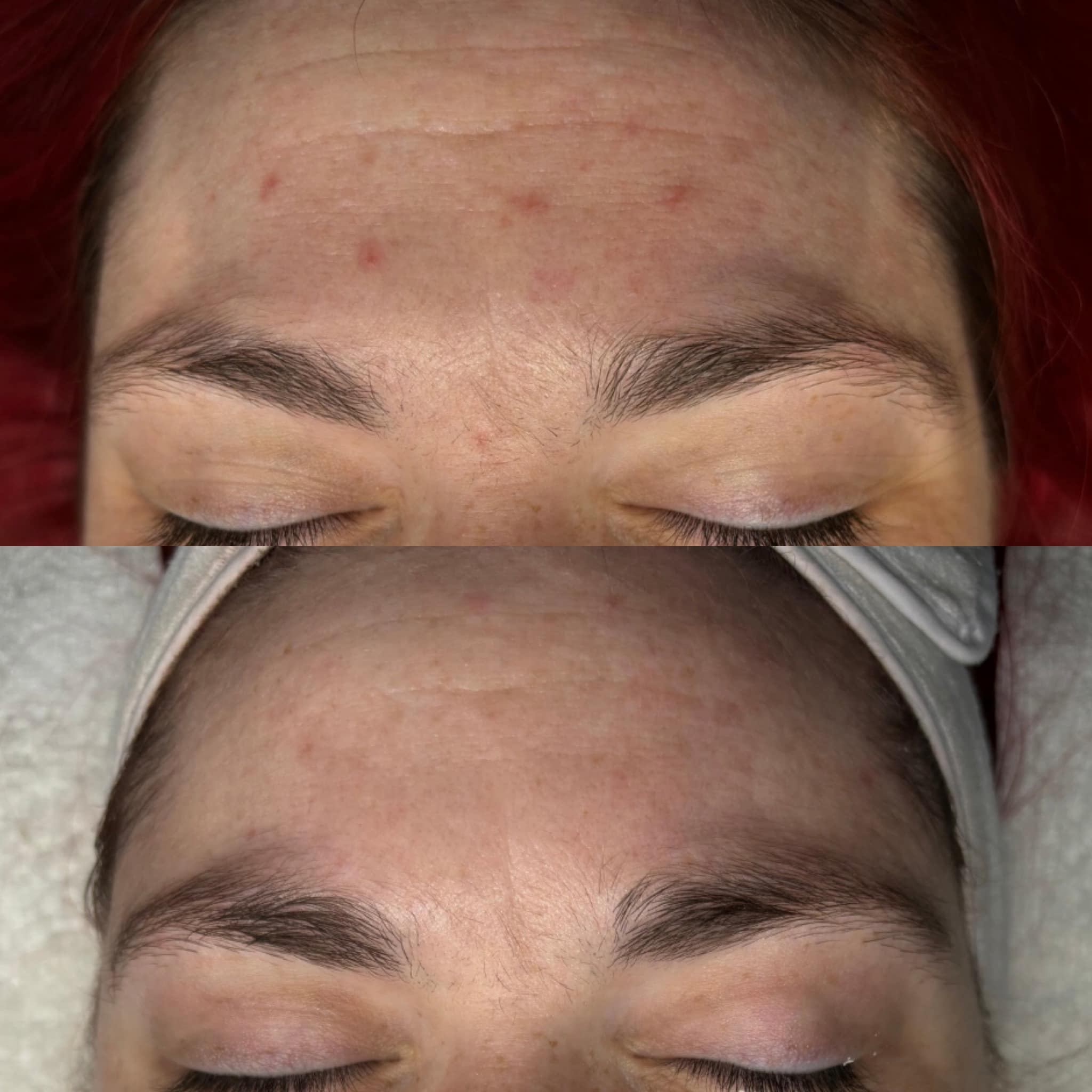 Images MKN Esthétique Laser & Bien-être