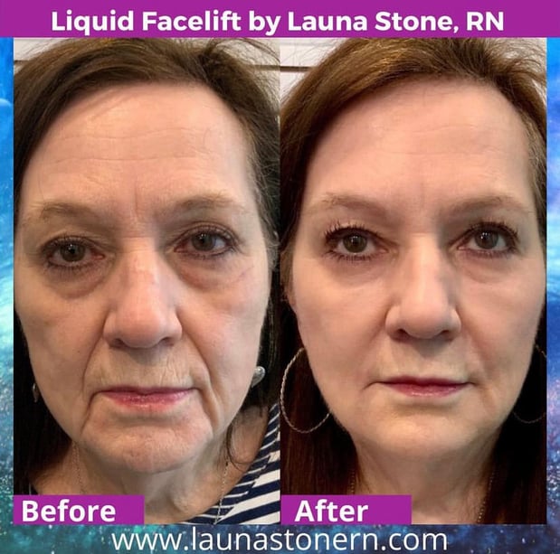 Images Launa Stone, R.N.