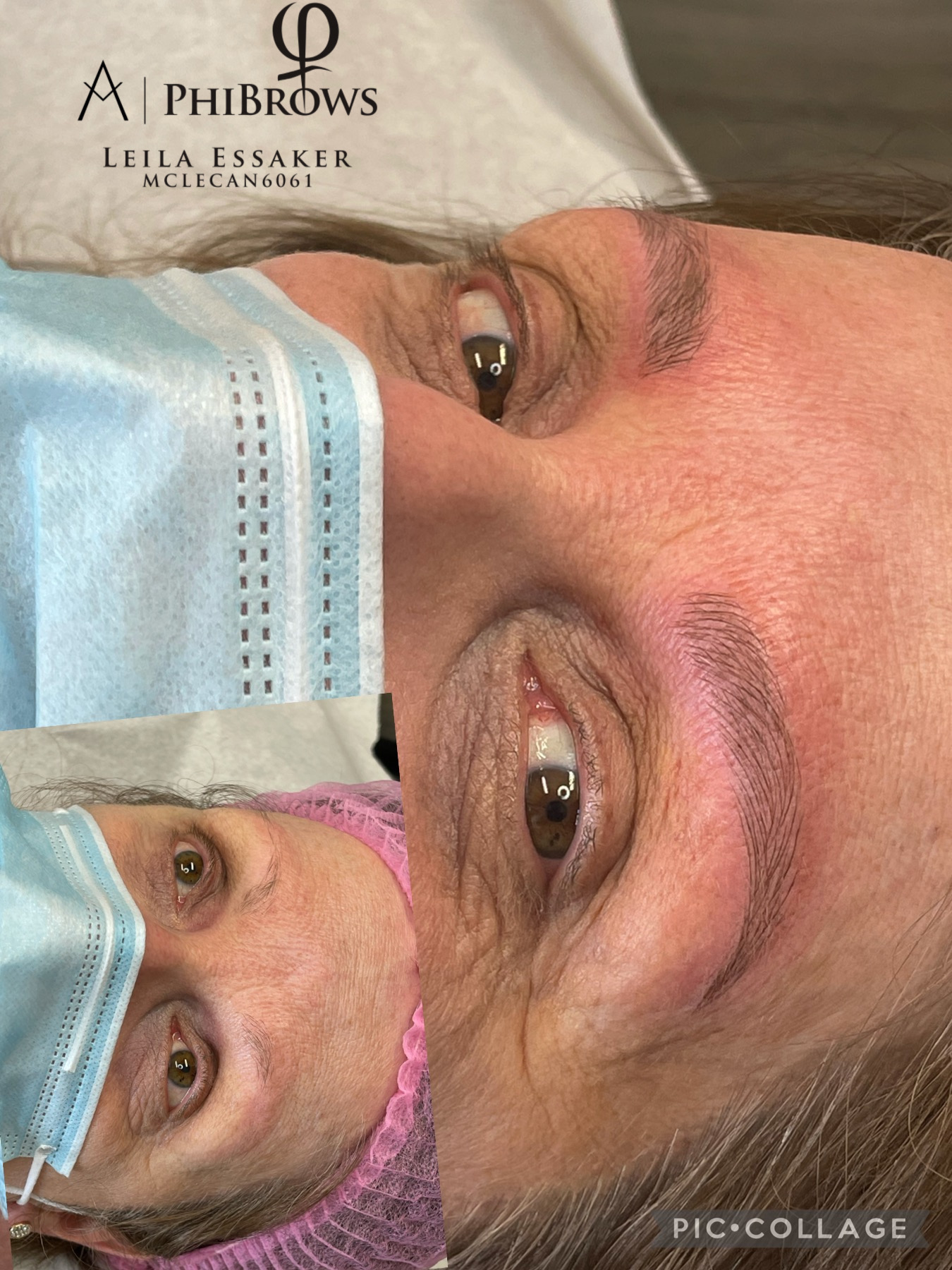 Images Clinique d'Esthétique Leila - Hydrafacial, Microblading, Épilation Laser Sainte-Foy