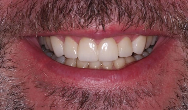 Images SmileCare Dental