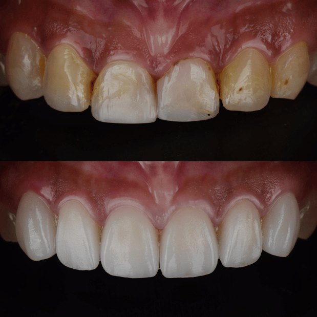 Images Jeppson Dental