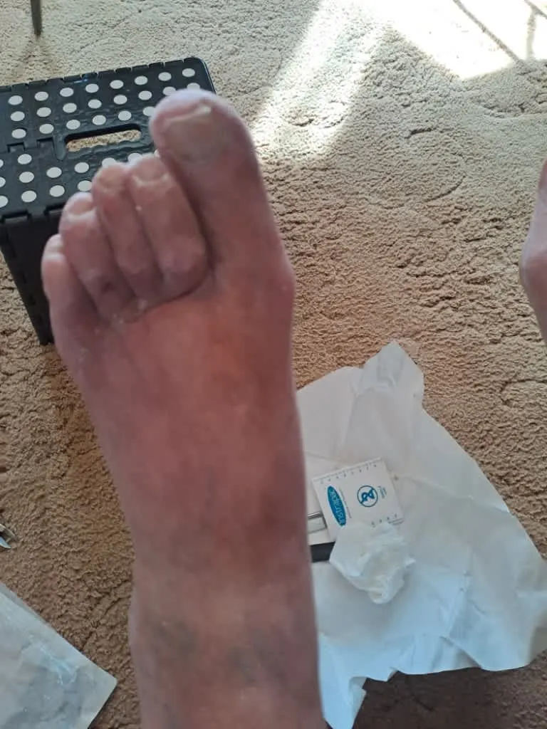 Images Foot Soldiers Podiatry