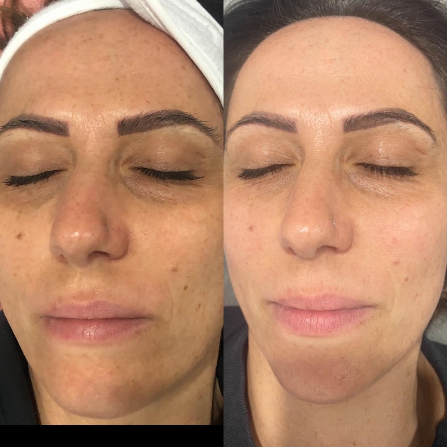 Images Luminous Skin