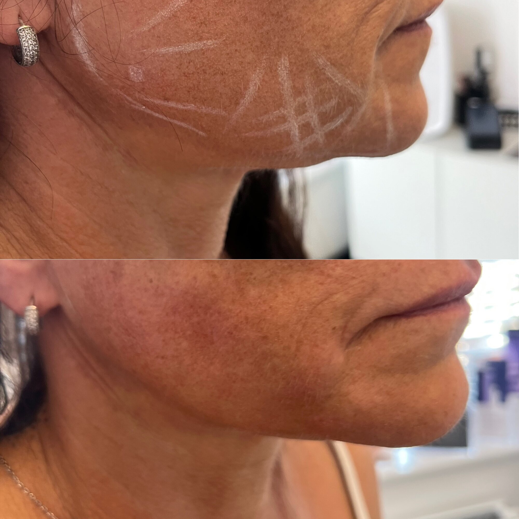 Images Harvey Medical Aesthetics