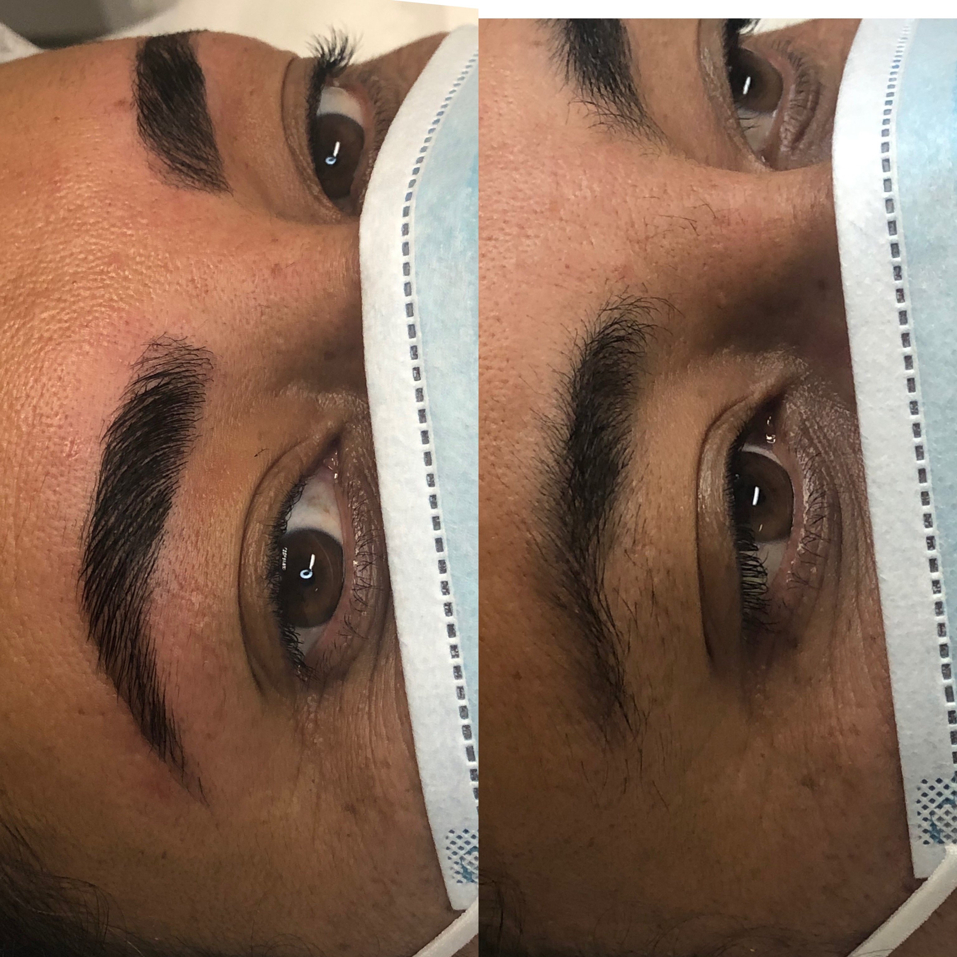 Images Clinique d'Esthétique Leila - Hydrafacial, Microblading, Épilation Laser Sainte-Foy
