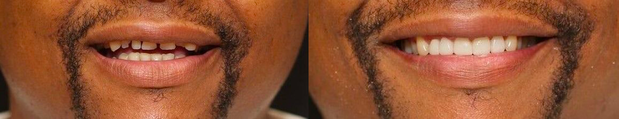 Images Cosmetic and Implant Dentistry of Connecticut