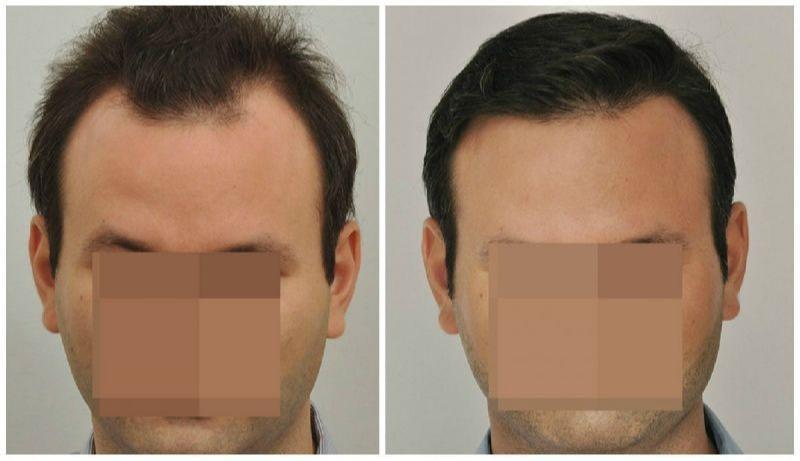 Images ForHair NYC Restoration Clinic - Dr. John Cole