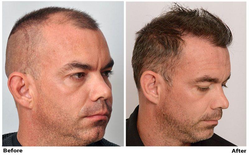 Images ForHair NYC Restoration Clinic - Dr. John Cole