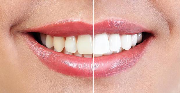 Images Riviera Smiles - Santa Barbara Dentist - Dr. Ana Martinez
