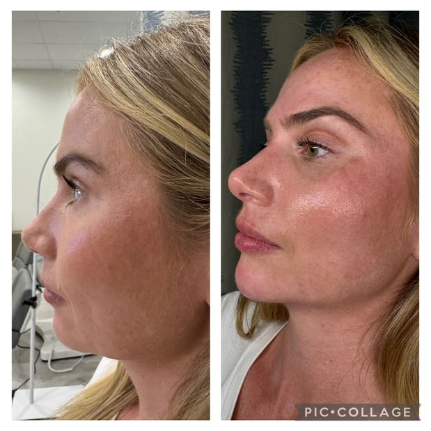 Images ReNu Self Medical