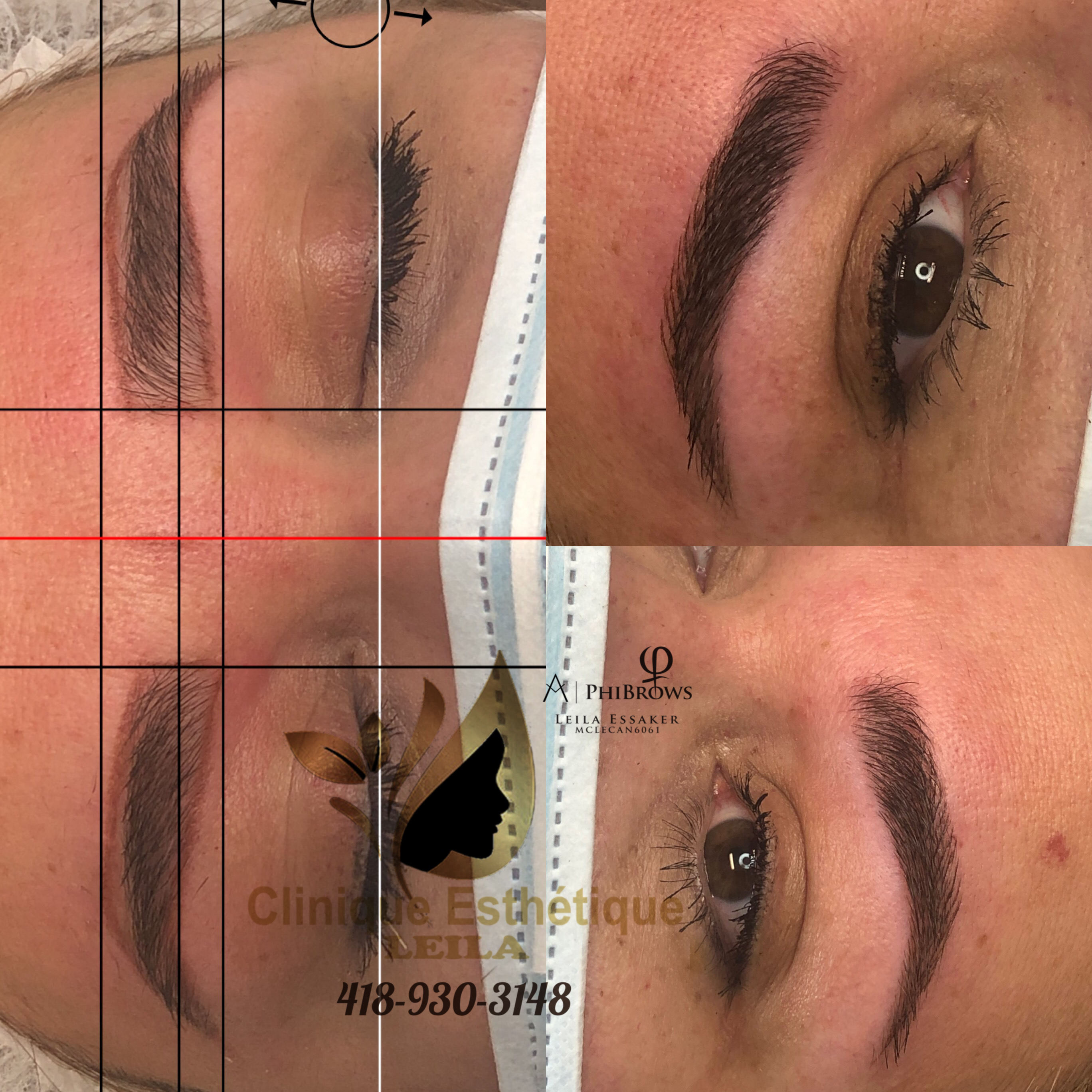 Images Clinique d'Esthétique Leila - Hydrafacial, Microblading, Épilation Laser Sainte-Foy
