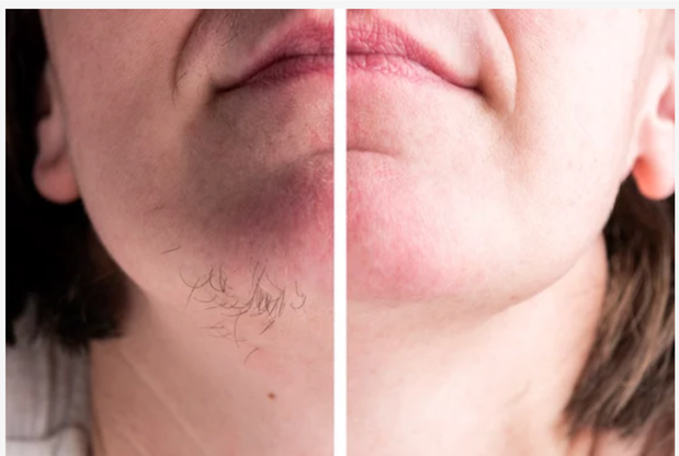 Images Ginger Lily Med Spa