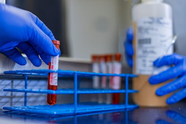 Images ImmunoTek Plasma