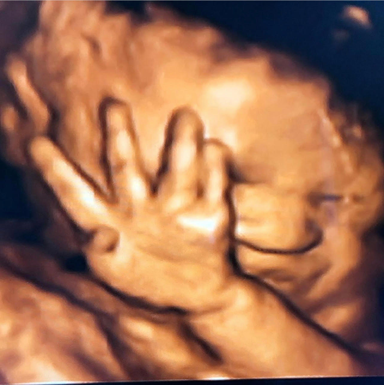 Image 6 | Belly 2 Birth 3D 4D Ultrasound