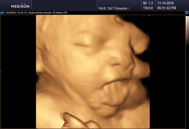Images Heavenly 3D 4D Ultrasounds