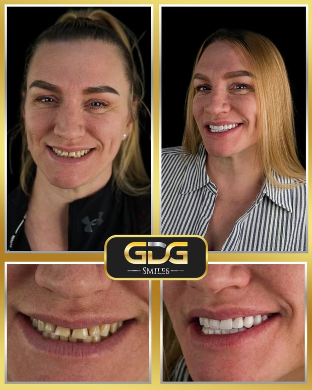 Images GDG Smiles