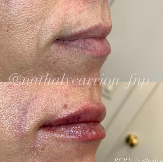 Images BCRN Aesthetics MedSpa