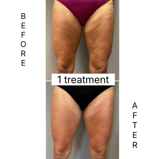 Images Sunkissed Med Spa