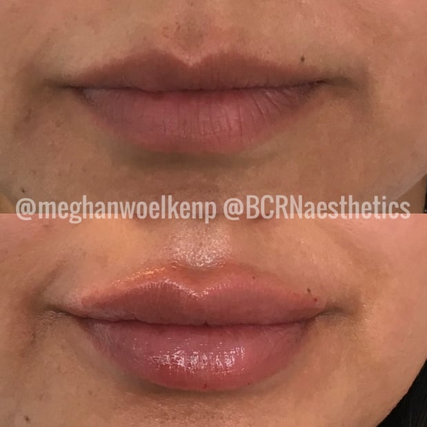 Images BCRN Aesthetics MedSpa