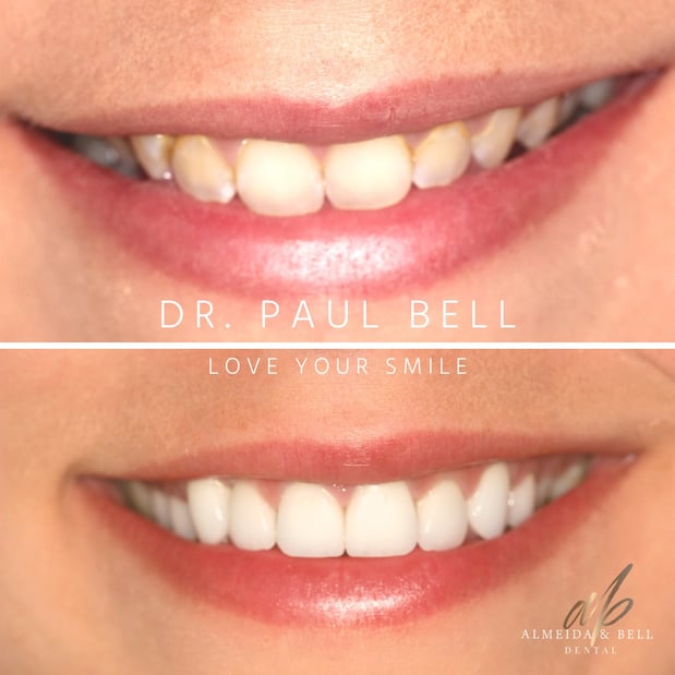 Images Almeida & Bell Dental Lone Tree - General, Cosmetic, and Implant Dentistry