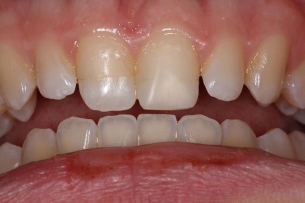 Images North Salem Dental Care