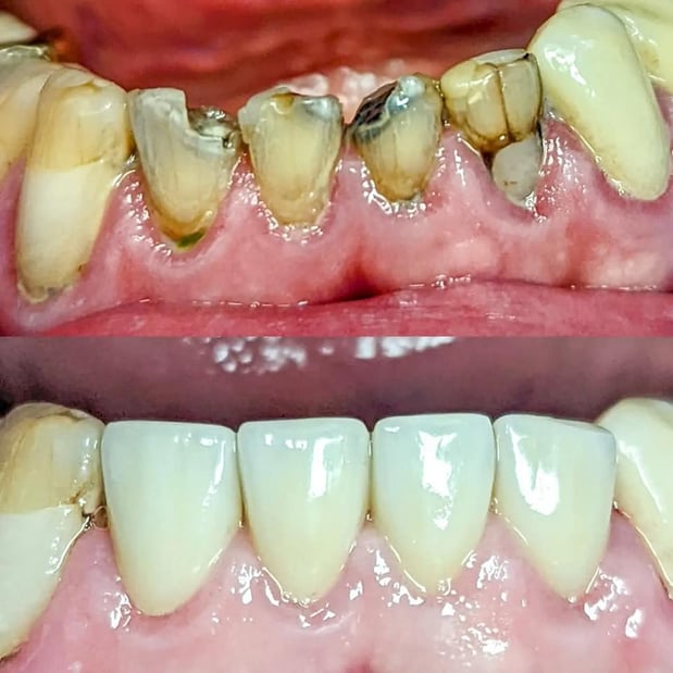 Images Northeast Lincoln Family Dentistry