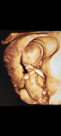 Images Love At First Sight 3D/4D Ultrasound Imaging Studio, LLC