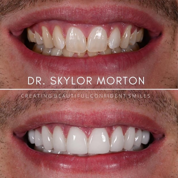 Images Nashville Wisdom Teeth and Implant Solutions