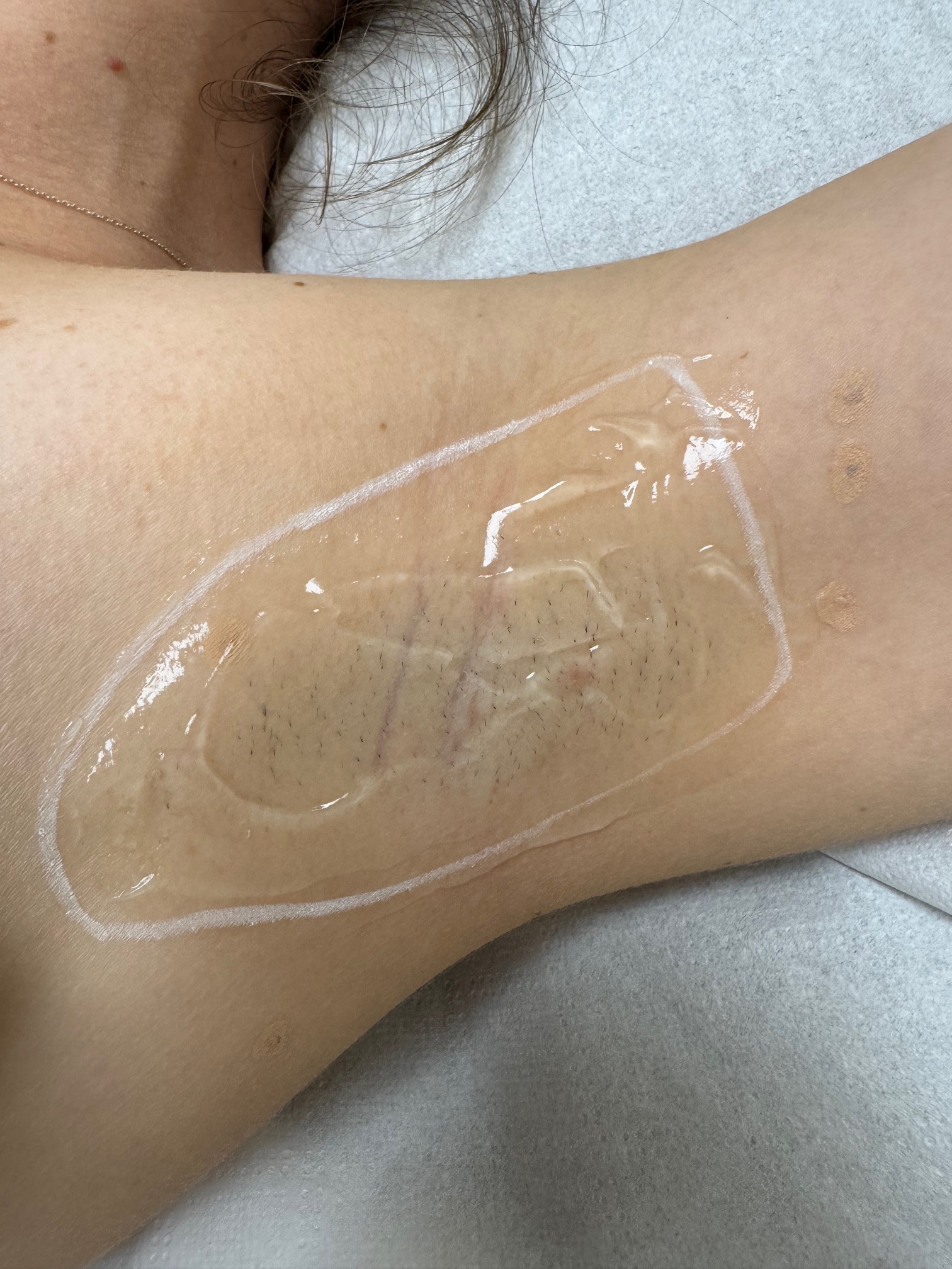 BOG Beauty & Aesthetics GbR, Meerfeldstr. 57 in Mannheim