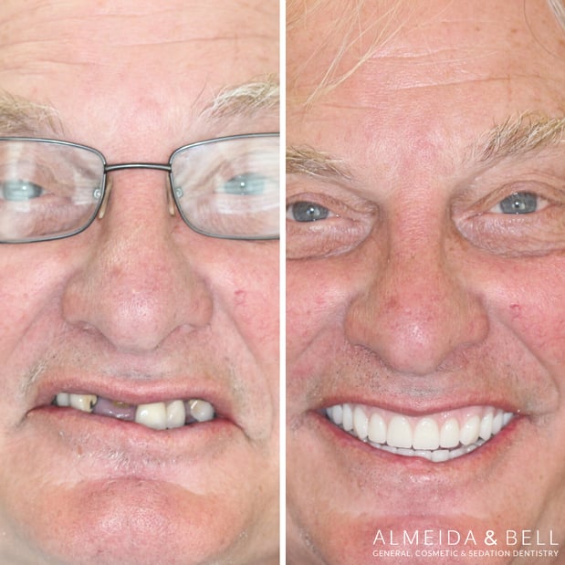 Images Almeida & Bell Dental Lone Tree - General, Cosmetic, and Implant Dentistry