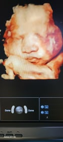 Images Love At First Sight 3D/4D Ultrasound Imaging Studio, LLC