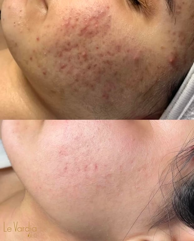 Images Le Vardia Skin