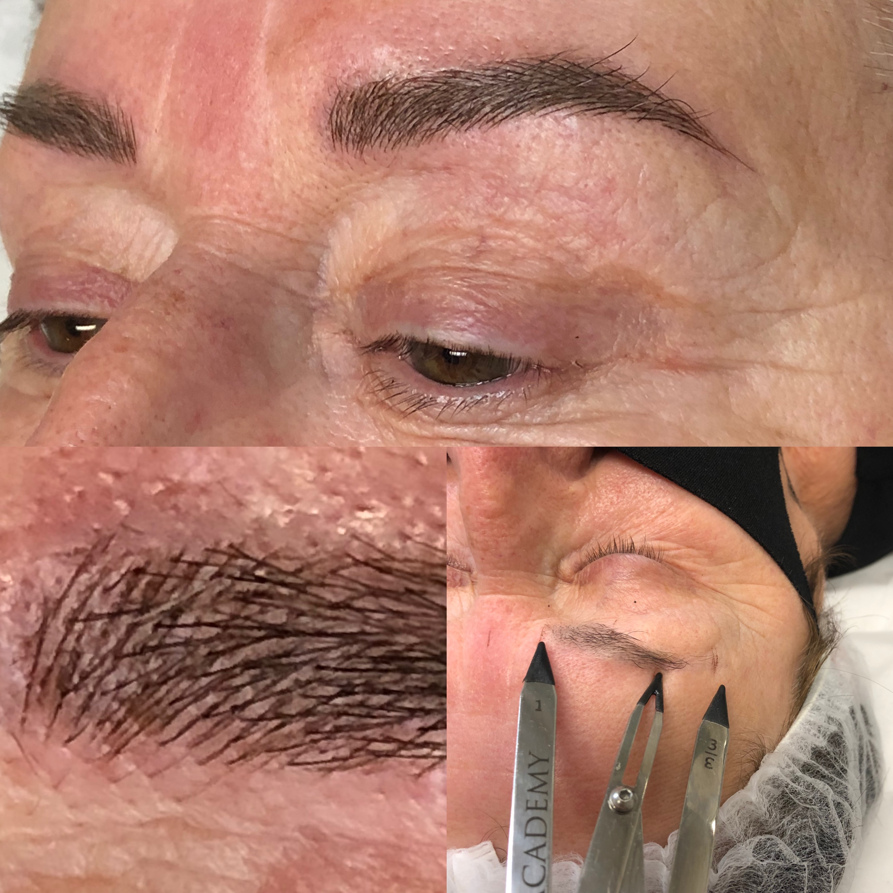 Images Clinique d'Esthétique Leila - Hydrafacial, Microblading, Épilation Laser Sainte-Foy
