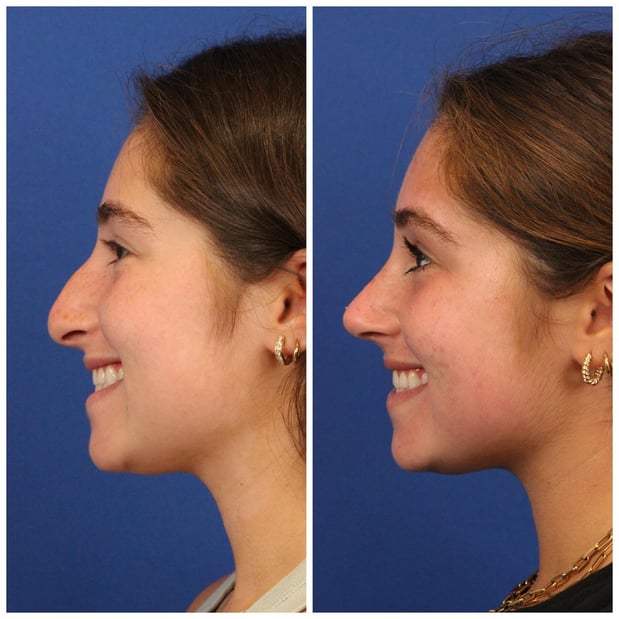 Images Dr. Sumit Bapna, MD