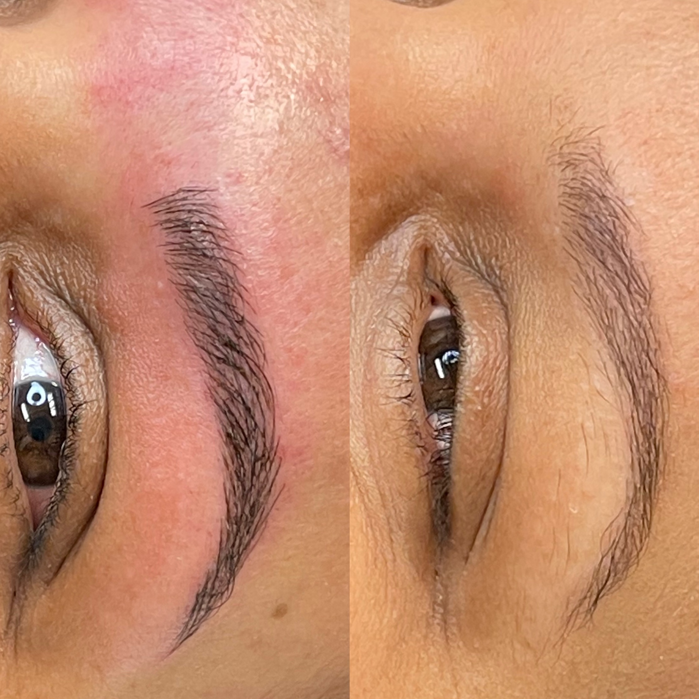 Images Clinique d'Esthétique Leila - Hydrafacial, Microblading, Épilation Laser Sainte-Foy