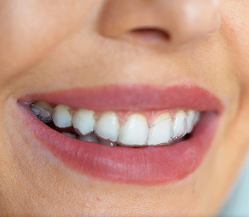 Images Dada Studi Dentistici