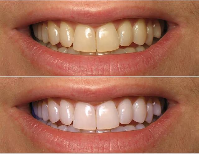 Images Smiles By Eddie: Dr. Edmond Ahdoot DDS