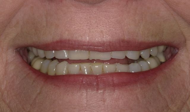 Images SmileCare Dental