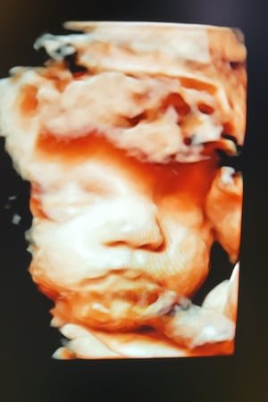 Images Love At First Sight 3D/4D Ultrasound Imaging Studio, LLC