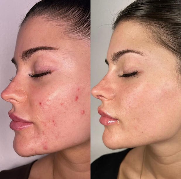 Images Face of Jules