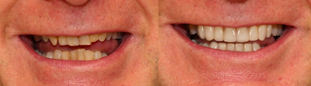 Images Cosmetic and Implant Dentistry of Connecticut