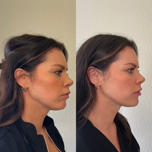 Images SM Drip Med Spa