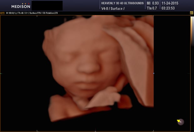 Images Heavenly 3D 4D Ultrasounds-Upland