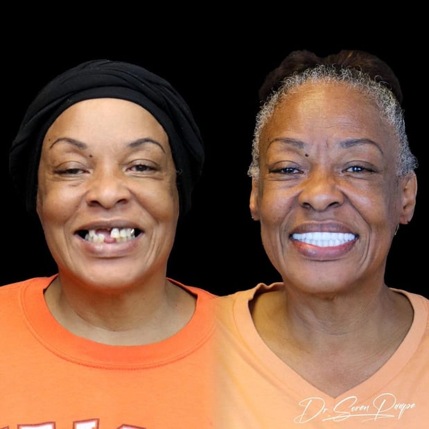 Images Smile Now Denver Dentures and Implants