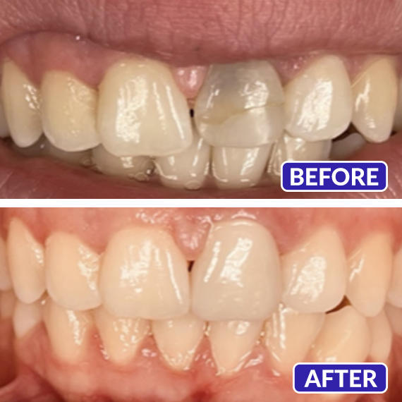 Images Smile Design Dentistry & Implant Center